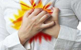 Изжога при заболеваниях поджелудочной железы