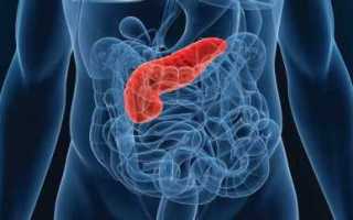 Сахарный диабет и поджелудочная железа — возможные осложнения при заболевании