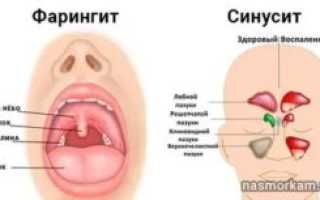 Болит горло и живот
