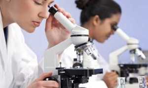 Что означает глюкоза в моче