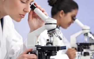 Что означает глюкоза в моче