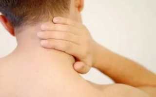 Припухлость на затылке