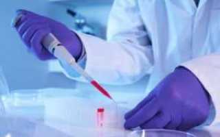 Какие анализы бывают на сахар в крови