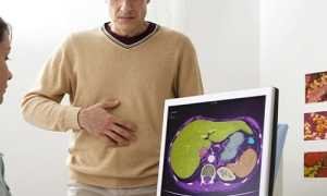 Симптоматика и причины панкреатита у мужчин