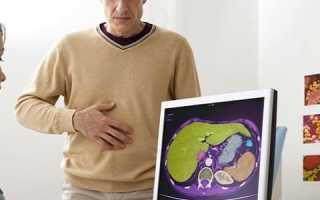 Симптоматика и причины панкреатита у мужчин