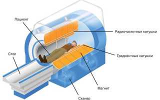 Вредно ли МРТ с контрастом и без: показания и противопоказания к проведению обследования