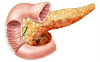 Лечение поджелудочной железы в домашних условиях