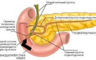 Воспаление поджелудочной железы