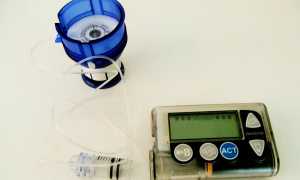 Микроинфузионная инсулиновая помпа – новое слово в лечении диабета