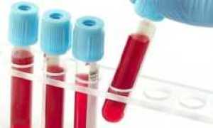 Анализ крови на скрытый сахар