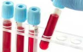 Анализ крови на скрытый сахар