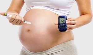 Признаки диабетической фетопатии у плода и как лечить такой диагноз?