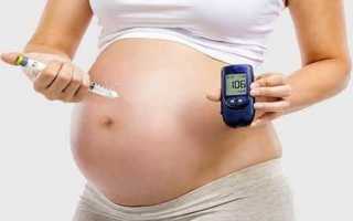Признаки диабетической фетопатии у плода и как лечить такой диагноз?