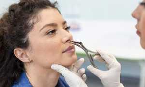 Удаление полипов в носу: Причины, Симптомы, Методы и Последствия