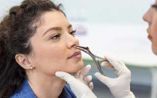 Удаление полипов в носу: Причины, Симптомы, Методы и Последствия