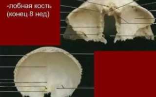 Выпирает лобная кость