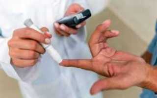 Как выявить сахарный диабет в домашних условиях