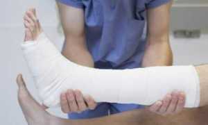 Перелом при диабете опасен – почему?