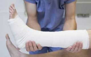 Перелом при диабете опасен – почему?