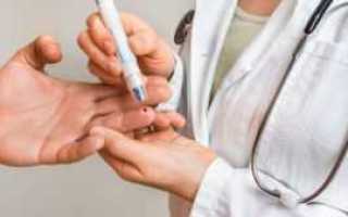 Что такое вторичный сахарный диабет