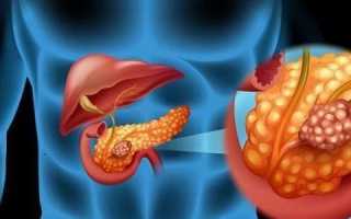 Проведение дренажа на поджелудочной железе: послеоперационная необходимость и результат