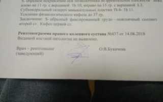 Пояснение заключения рентгенолога