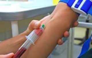 Высокий сахар в крови у мужчин причины и симптомы