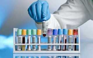 Как обследовать поджелудочную железу