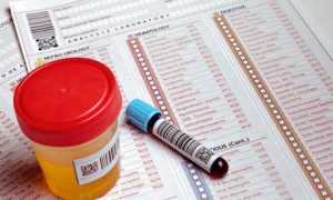 Ранняя диагностика сахарного диабета, ее принципы в зависимости от типа заболевания