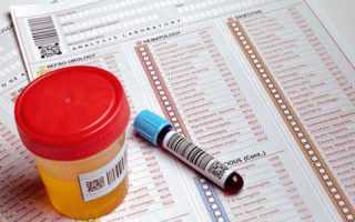 Ранняя диагностика сахарного диабета, ее принципы в зависимости от типа заболевания