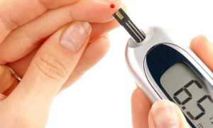 Как диагностировать сахарный диабет методы диагностики