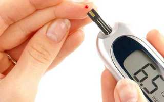 Как диагностировать сахарный диабет методы диагностики