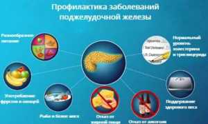 Профилактика заболеваний поджелудочной железы