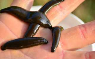 Что такое гирудотерапия: как пиявки могут помочь здоровью?