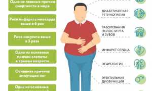 Причины возникновения сахарного диабета