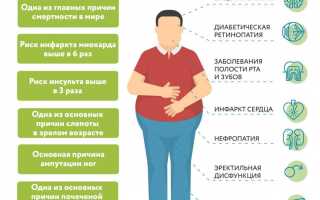 Причины возникновения сахарного диабета