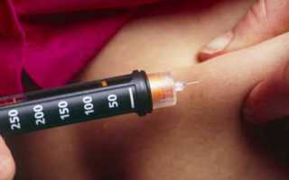 Как колоть инсулин? Поддержание углеводного обмена без страха и дискомфорта