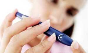 Сахарный диабет — признаки заболевания и его симптоматика