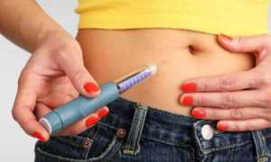 Инсулинотерапия при сахарном диабете