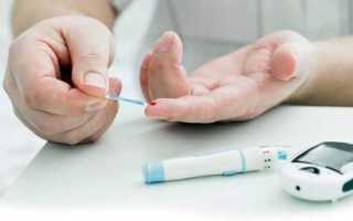 Последствия сахарного диабета
