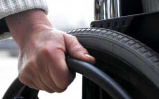 Группа инвалидности при ампутации ноги выше колена