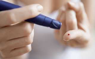 Как называется анализ на сахар в крови