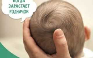 Родничок закрылся в 4 месяца, это норма?