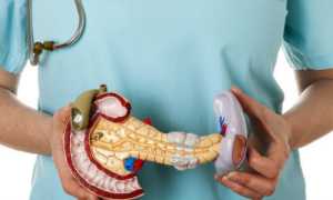 Реабилитация после лечения острого панкреатита