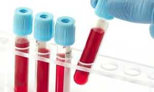 Нужно ли сдавать анализ на инсулин