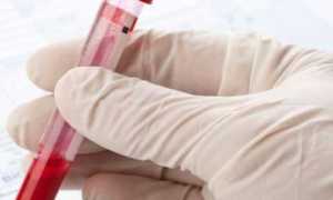 Норма глюкозы в крови: отличие по возрастным категориям, возможные отклонения