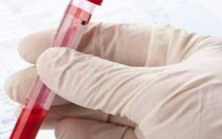 Норма глюкозы в крови: отличие по возрастным категориям, возможные отклонения