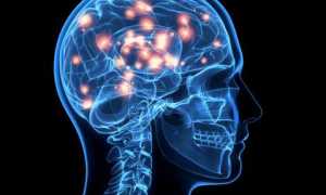 Как развивается энцефалопатия диабетическая, лечение, прогноз