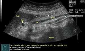 УЗИ поджелудочной железы