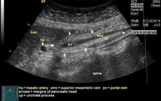 УЗИ поджелудочной железы